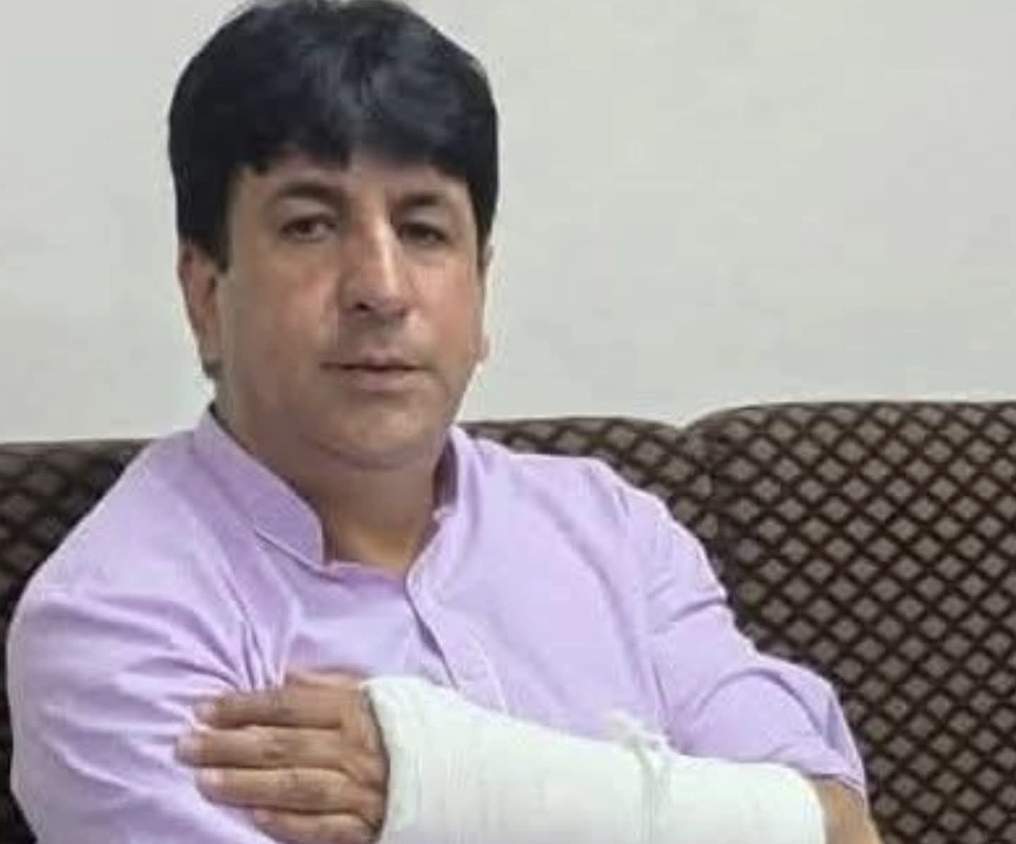 J&K MLA suffers multiple  injuries after hit by Car 