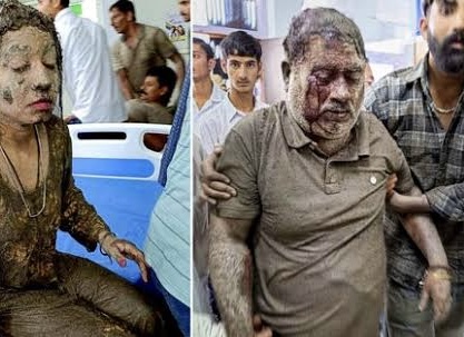J&K Health Dept launches Medical Response after Cloud Burst; Doctors from PGI Chandigarh reaching GMC Jammu