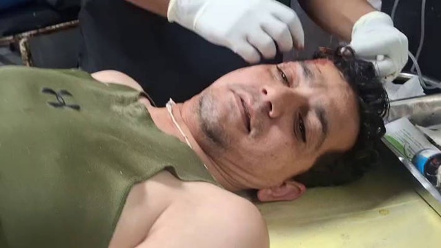 J&K: Police Sub Inspector critically injured after attack by goons, manhunt launched